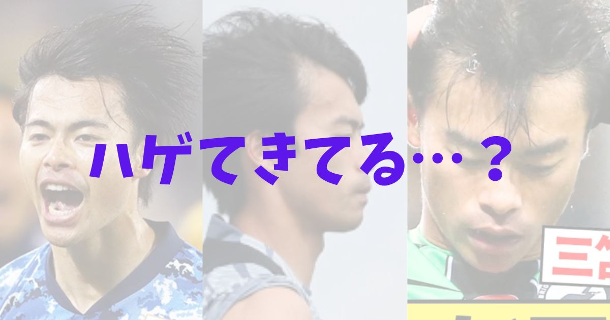 三笘薫　三苫　髪の毛　ハゲてる　禿げた　薄い　後頭部　頭頂部　後ろ姿　昔　現在　2024年