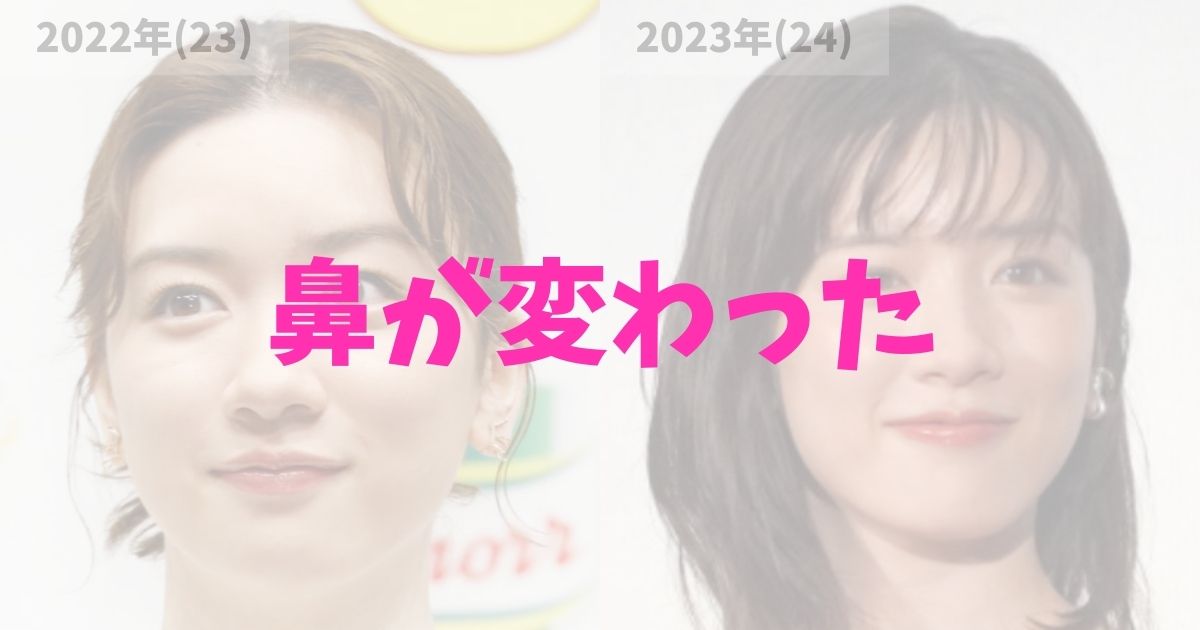 永野芽郁の鼻先が変わったのはいつ？整形なのか？の記事