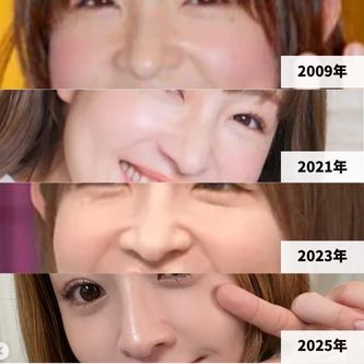 2009年～2025年現在までの大沢あかねの鼻の比較画像