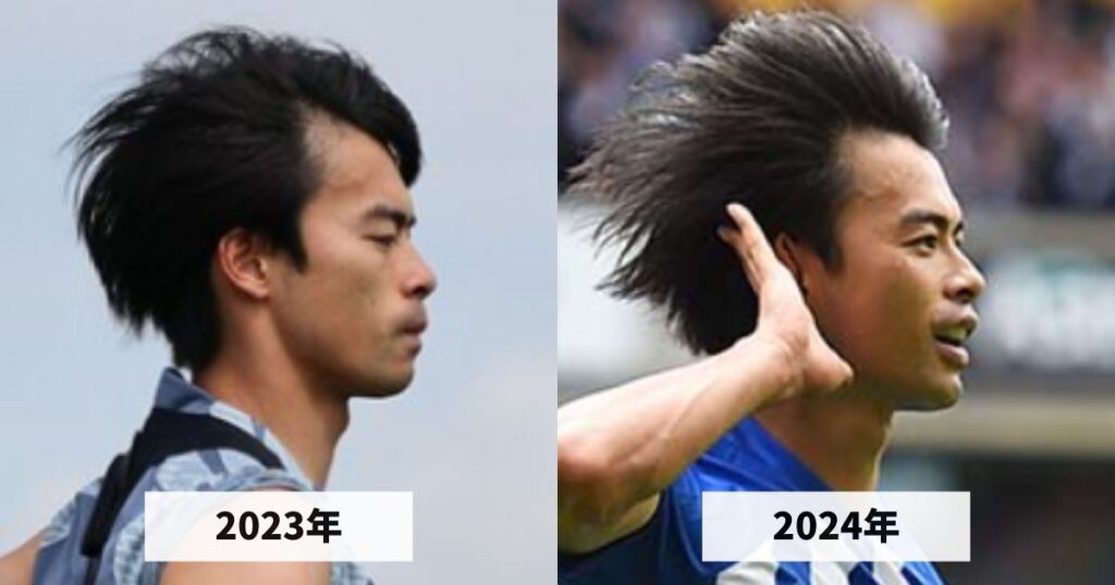 2023年と2024年の三笘薫選手の生え際のハゲ具合を比較した画像