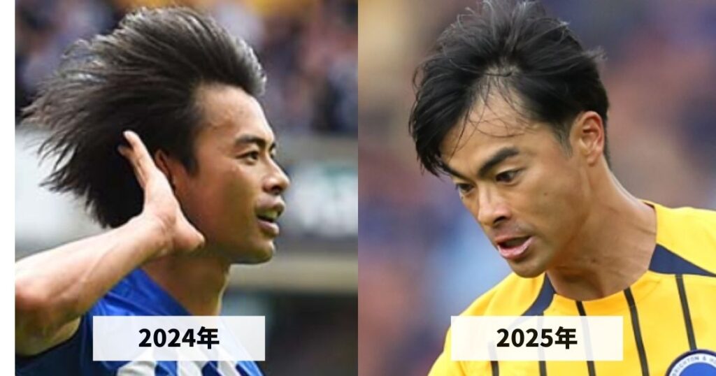 2024年と2025年の三笘薫選手の生え際のハゲ具合を比較した画像