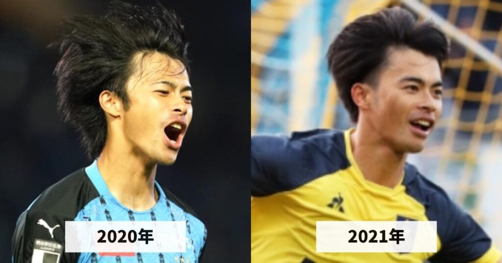 2020年と2021年の三笘薫選手の生え際のハゲ具合を比較した画像