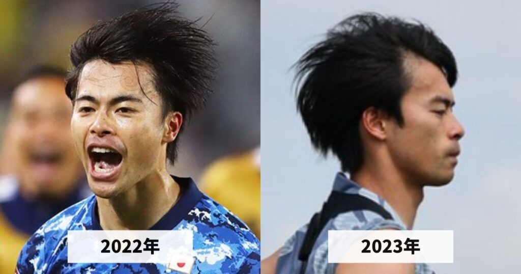 2022年と2023年の三笘薫選手の生え際のハゲ具合を比較した画像